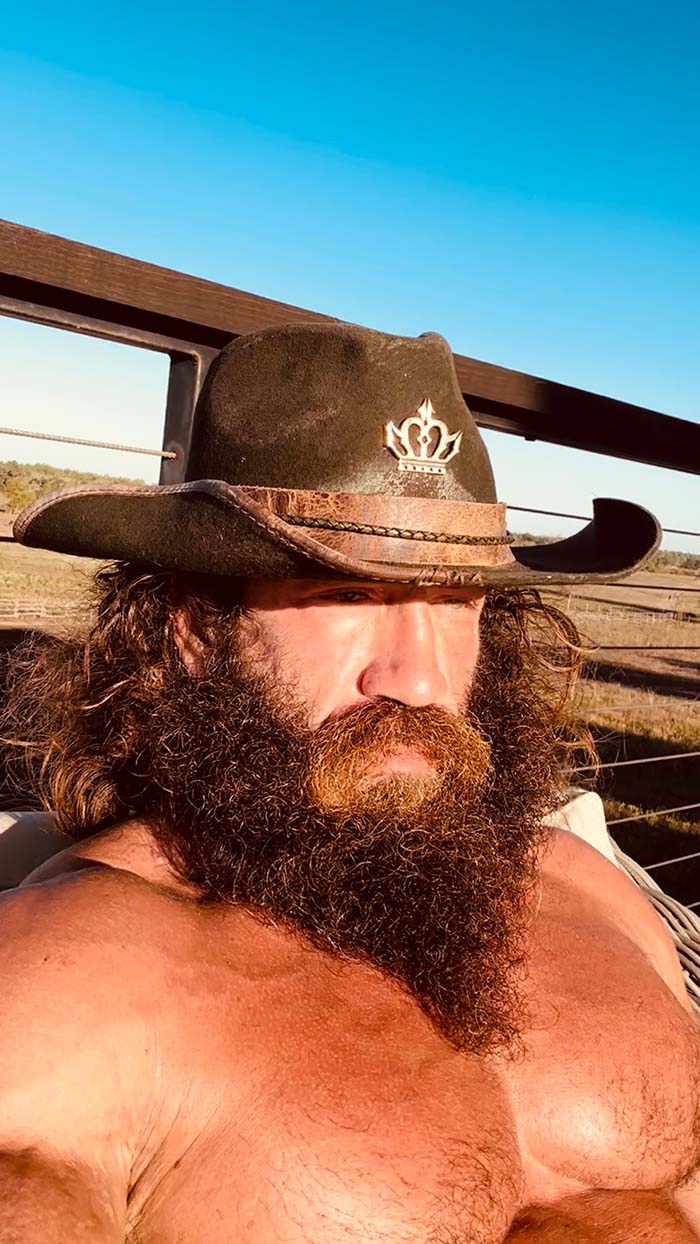 Liver King’s Last Eye Update, Medical Records, Liver King Not Looking